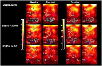 GABAergic Control of Nigrostriatal and Mesolimbic Dopamine in the Rat Brain